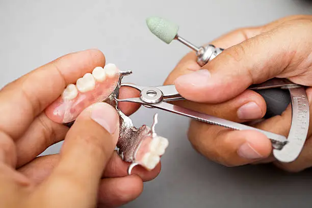 Overdentures
