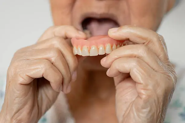 What is it like living with dentures