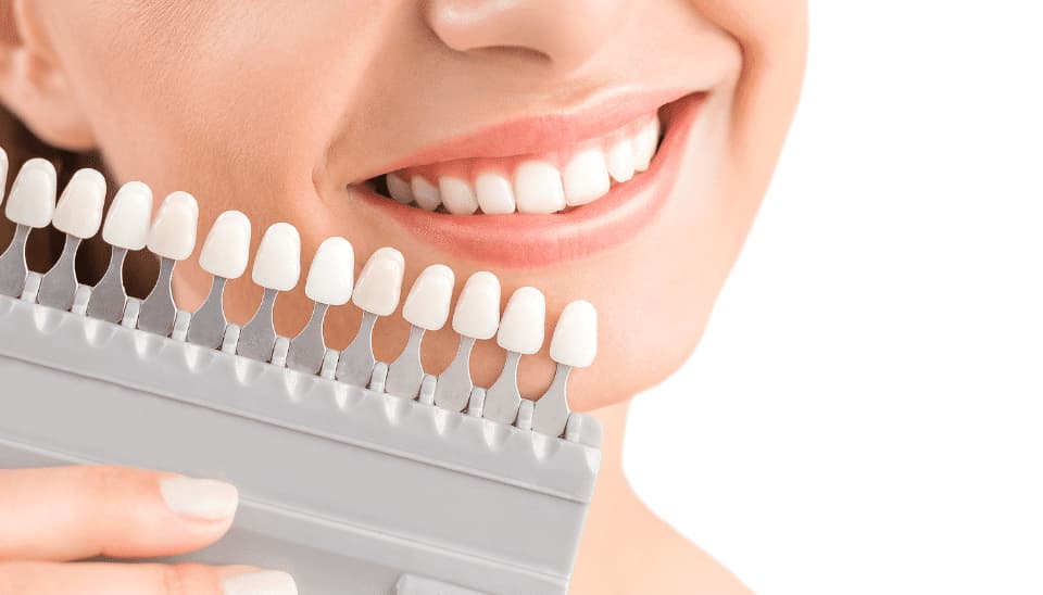 A chart showing the different levels of teeth whitening next to a woman's teeth