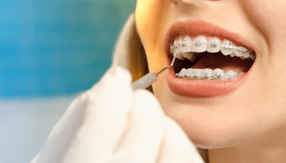 A close up of a female having an orthodontic brace fitted