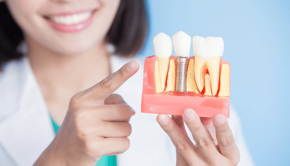 Image of a dentist pointing towards a dental implant replica