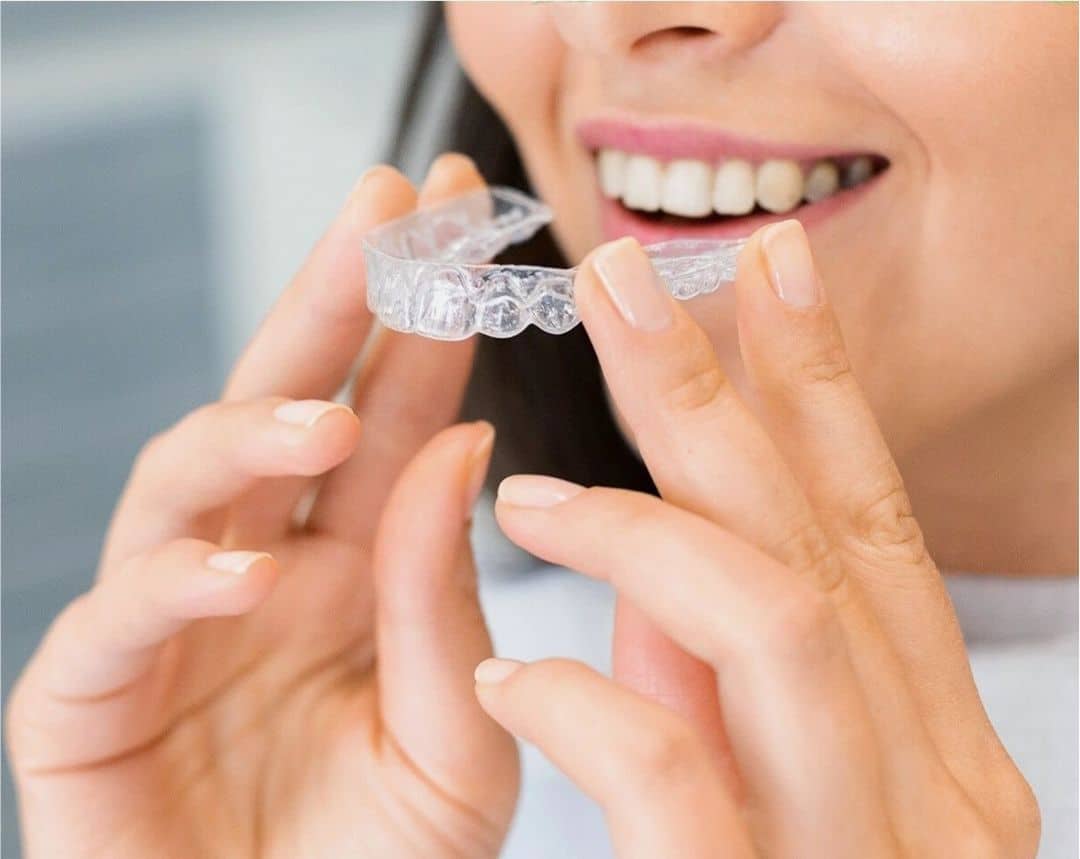 Invisalign Braces