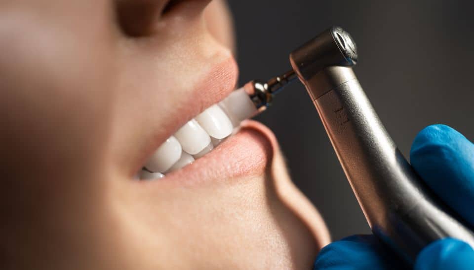 Polishing as part of a professional teeth clean