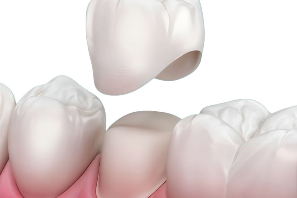 Same-Day Crown Illustration
